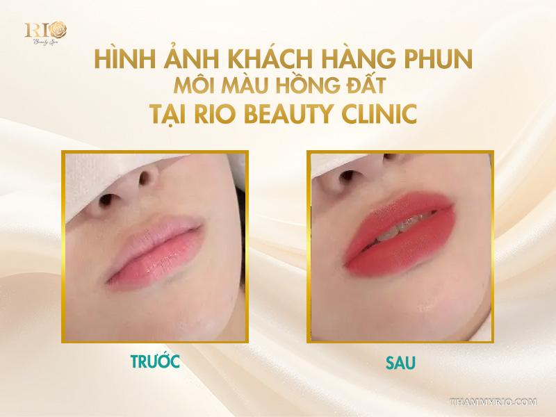 Phun môi màu hồng đất là gì? Bảng màu và quy trình chuẩn 2025 7 Hình ảnh khách hàng phun môi màu hồng đất tại Rio Beauty Clinic