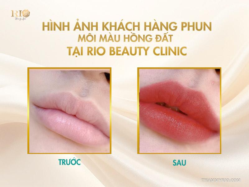 Phun môi màu hồng đất là gì? Bảng màu và quy trình chuẩn 2025 8 Hình ảnh khách hàng phun môi màu hồng đất tại Rio Beauty Clinic