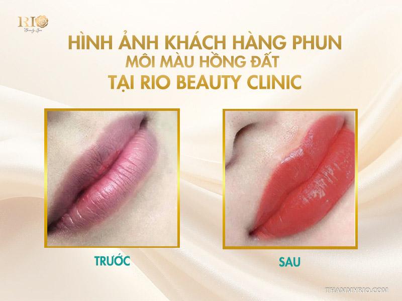 Phun môi màu hồng đất là gì? Bảng màu và quy trình chuẩn 2025 9 Hình ảnh khách hàng phun môi màu hồng đất tại Rio Beauty Clinic