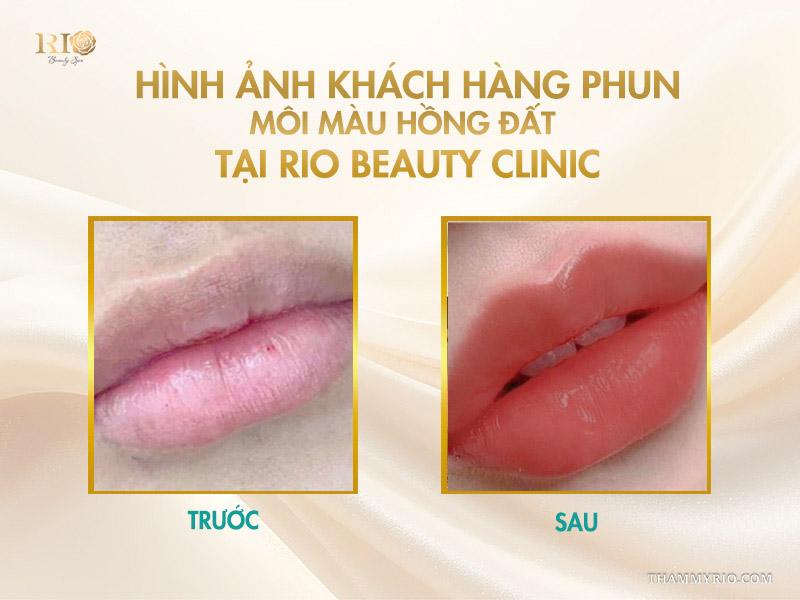Phun môi màu hồng đất là gì? Bảng màu và quy trình chuẩn 2025 10 Hình ảnh khách hàng phun môi màu hồng đất tại Rio Beauty Clinic