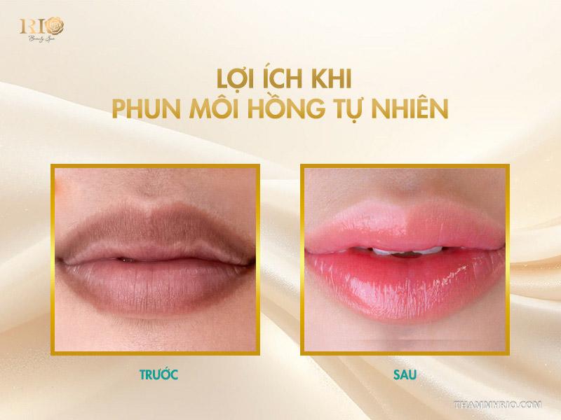 Phun môi màu hồng tự nhiên – Gam màu trẻ hóa mọi độ tuổi 3 Lợi ích khi phun môi hồng tự nhiên