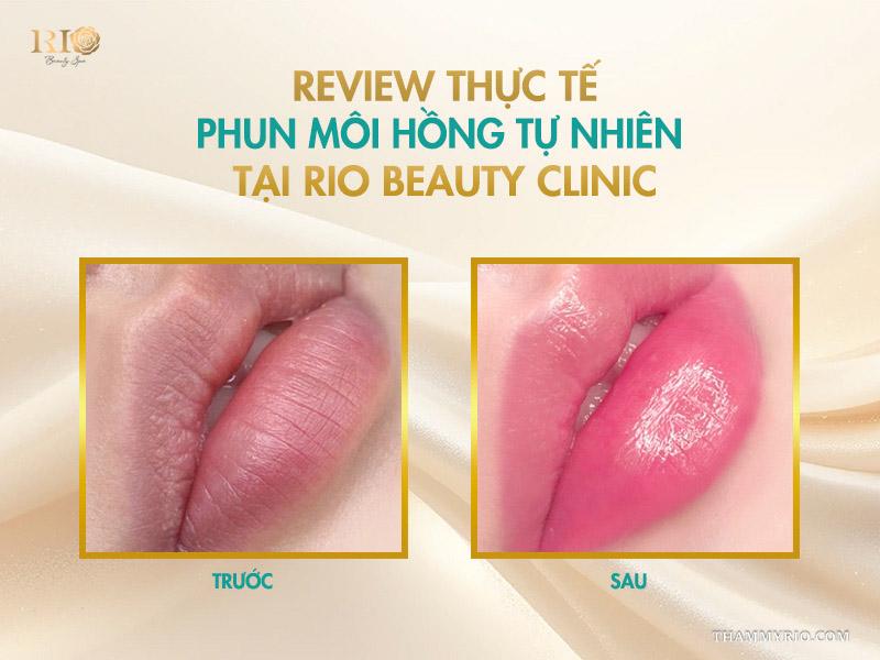 Phun môi màu hồng tự nhiên – Gam màu trẻ hóa mọi độ tuổi 7 Review thực tế phun môi hồng tự nhiên tại Rio Beauty Clinic