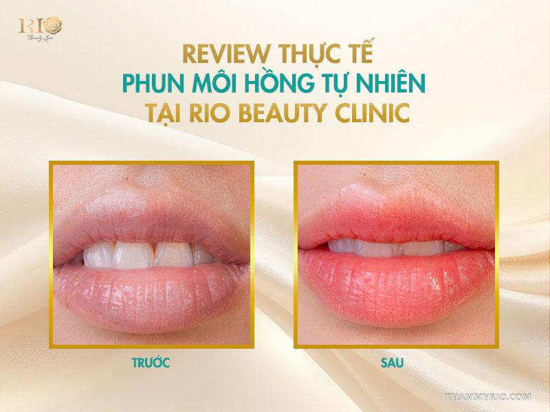 Phun môi màu hồng tự nhiên – Gam màu trẻ hóa mọi độ tuổi 8 Review thực tế phun môi hồng tự nhiên tại Rio Beauty Clinic