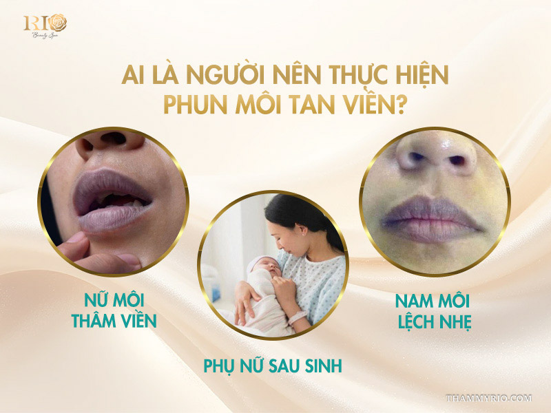 Phun môi tan viền -  Giải mã “cơn sốt” vạn người mê! 4 Ai là người nên thực hiện phun môi tan viền?