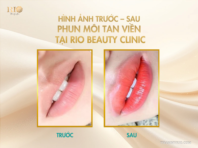 Phun môi tan viền -  Giải mã “cơn sốt” vạn người mê! 8 Hình ảnh trước – sau phun môi tan viền tại Rio Beauty Clinic