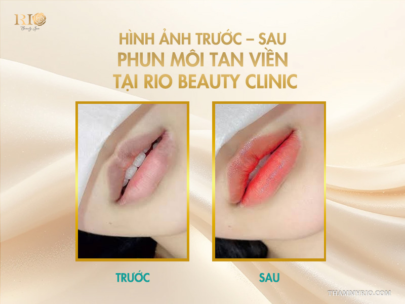 Phun môi tan viền -  Giải mã “cơn sốt” vạn người mê! 9 Hình ảnh trước – sau phun môi tan viền tại Rio Beauty Clinic