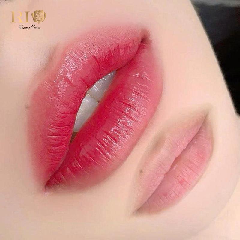 Phun môi tế bào gốc là gì? Lợi ích và giá dịch vụ mới nhất 7 Phun môi tế bào gốc mang lại vẻ đẹp tự nhiên, môi mềm và mướt như nhung.