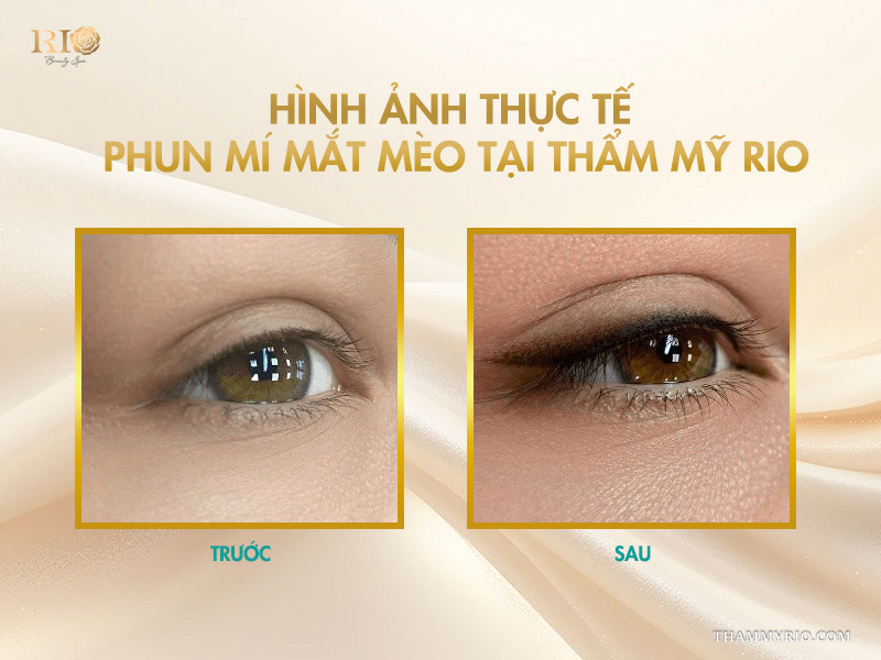 Giải mã độ hot phun mí mắt mèo tạo đường nét vạn người mê 6 Hình ảnh thực tế phun mí mắt mèo tại Thẩm mỹ Rio