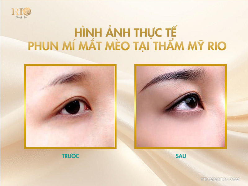 Giải mã độ hot phun mí mắt mèo tạo đường nét vạn người mê 7 Hình ảnh thực tế phun mí mắt mèo tại Thẩm mỹ Rio