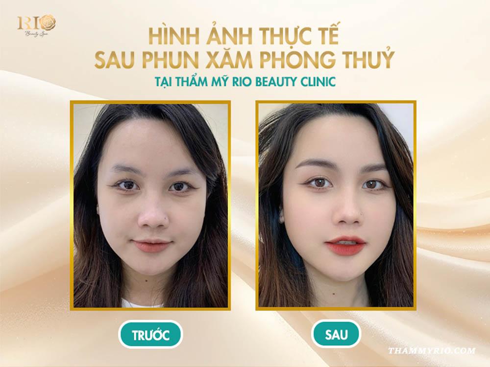 Phun xăm phong thủy: Thay đổi vận mệnh - Đẹp tự nhiên 8 Hình ảnh thực tế sau phun xăm phong thủy tại Thẩm mỹ Rio Beauty Clinic