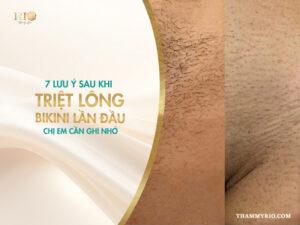 7 lưu ý sau khi triệt lông bikini lần đầu chị em cần ghi nhớ