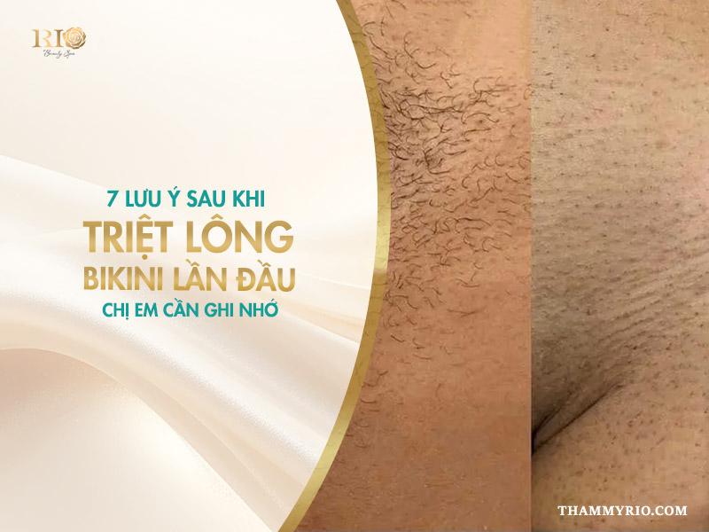 7 lưu ý sau khi triệt lông bikini lần đầu chị em cần ghi nhớ