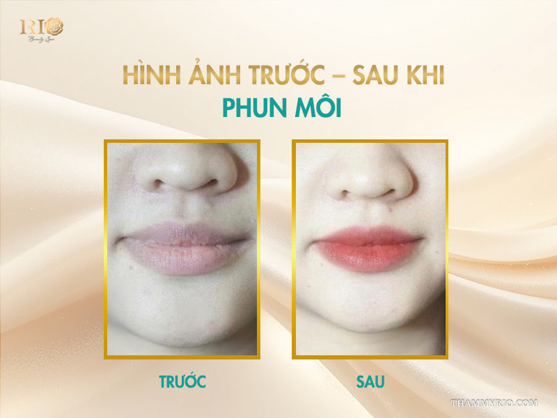 Dịch vụ phun môi chuẩn Hàn tại spa phun xăm Thẩm Mỹ Rio lên màu tươi tự nhiên