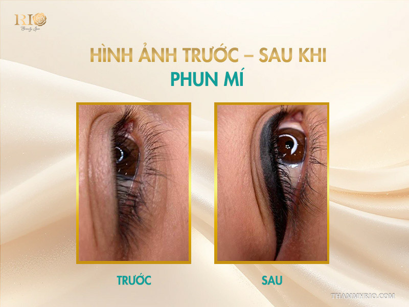 Phun mí mắt tại spa phun xăm Thẩm Mỹ Rio giúp đôi mắt to, rõ nét hơn