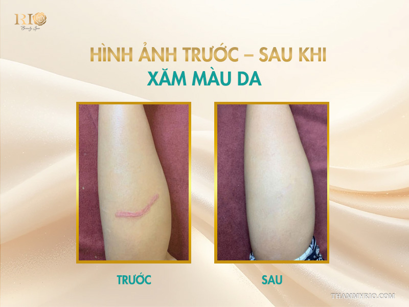 Dịch vụ xăm màu da tại spa phun xăm Thẩm Mỹ Rio giúp làm đều màu và che khuyết điểm tự nhiên