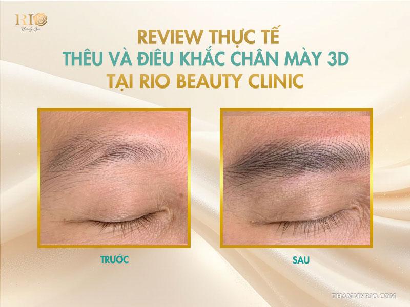 Nên chọn thêu chân mày 3D hay điêu khắc chân mày 3D? 7 Review thực tế thêu và điêu khắc chân mày 3D tại Rio Beauty Clinic