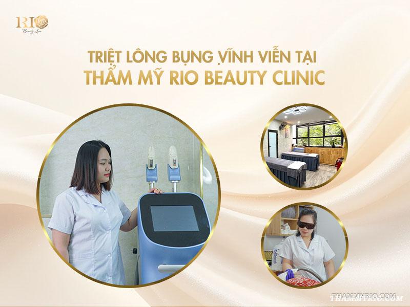 Có nên triệt lông bụng không? Có các cách triệt lông bụng nào? 7 Triệt lông bụng vĩnh viễn tại Thẩm mỹ Rio Beauty Clinic