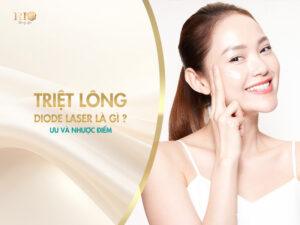 Triệt lông Diode Laser là gì?