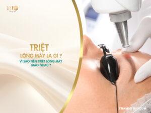 Triệt lông mày là gì? Vì sao nên triệt lông mày giao nhau?