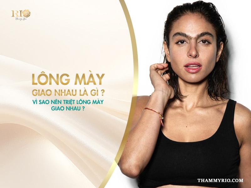 Triệt lông mày là gì? Vì sao nên triệt lông mày giao nhau? 4 Lông mày giao nhau là gì? Vì sao nên triệt lông mày giao nhau?