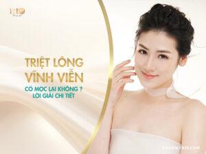 Triệt lông vĩnh viễn có mọc lại không? Giải đáp thắc mắc!