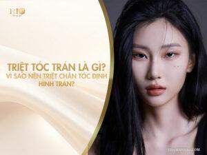 Triệt tóc trán là gì? Vì sao nên triệt chân tóc định hình trán?