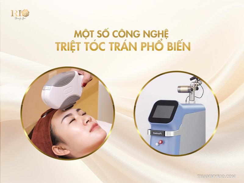 Triệt tóc trán là gì? Vì sao nên triệt chân tóc định hình trán? 5 Một số công nghệ triệt tóc trán phổ biến