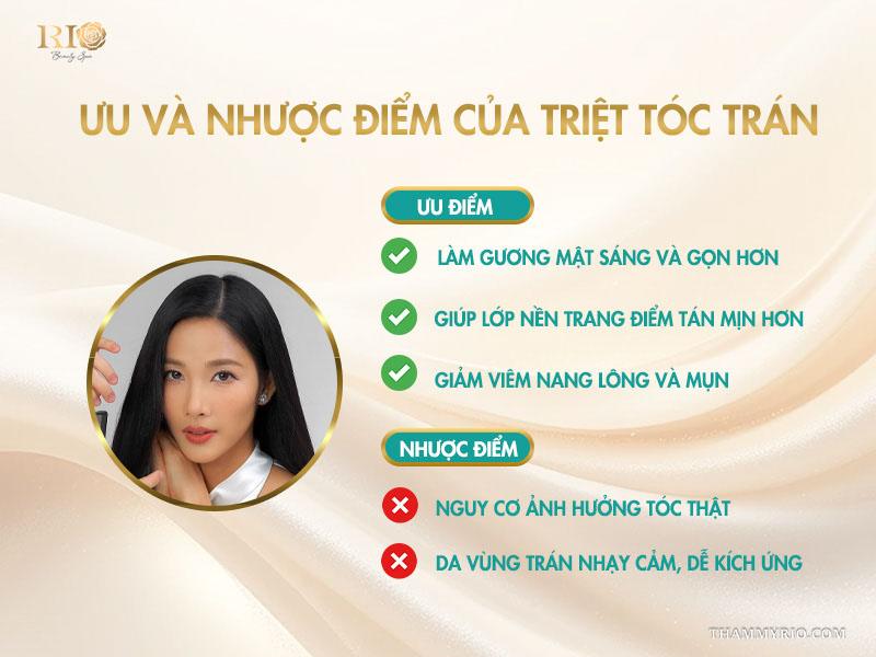 Triệt tóc trán là gì? Vì sao nên triệt chân tóc định hình trán? 3 Ưu và nhược điểm của triệt tóc trán