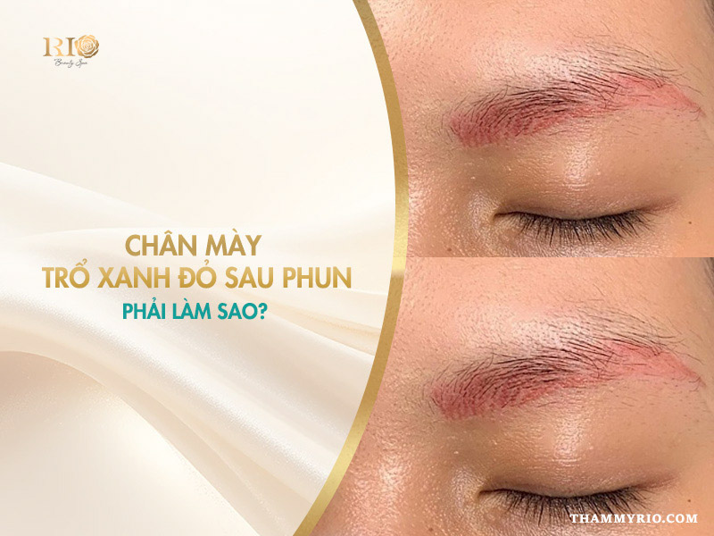chân mày trổ xanh