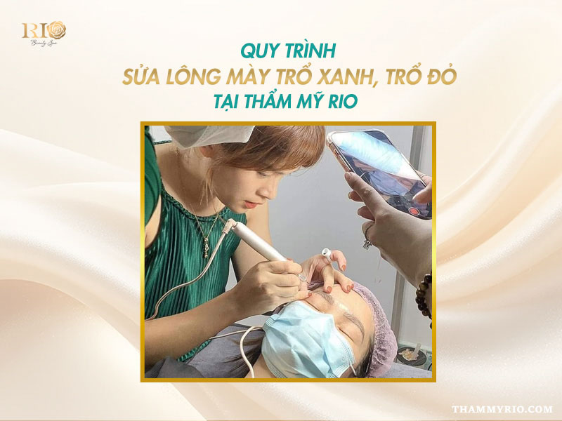 Chân mày trổ xanh, trổ đỏ sau phun: Nguyên nhân và cách xử lý 4 quy trình sửa lông mày trổ xanh trổ đỏ tại Thẩm Mỹ Rio
