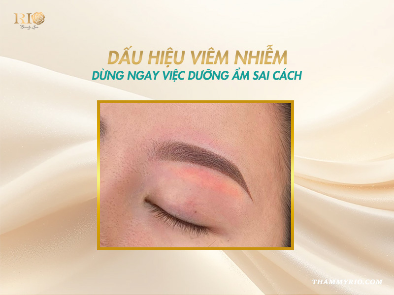 Có nên bôi Vaseline sau khi xăm mày? Hướng dẫn cách dùng đúng 5 Dấu hiệu viêm nhiễm - có nên bôi vaseline sau khi xăm mày