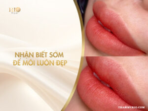 Dấu hiệu phun môi bị hỏng và cách nhận biết sớm để môi luôn đẹp tự nhiên.