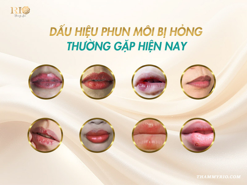 12 dấu hiệu phun môi bị hỏng thường gặp nhất hiện nay.