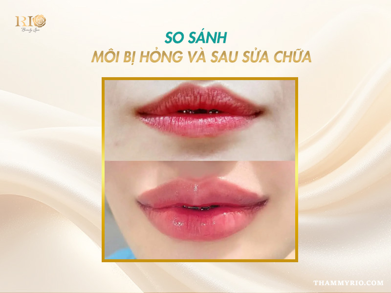 So sánh môi xăm bị hỏng và kết quả sau khi chỉnh sửa phun môi bị lỗi tại Rio.