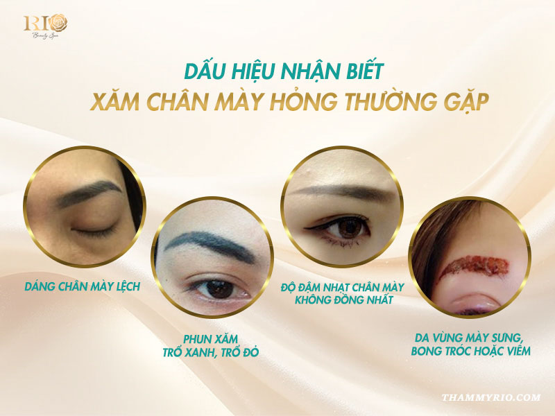 Dấu hiệu nhận biết xăm lông mày hỏng trổ xanh lệch dáng viêm sưng