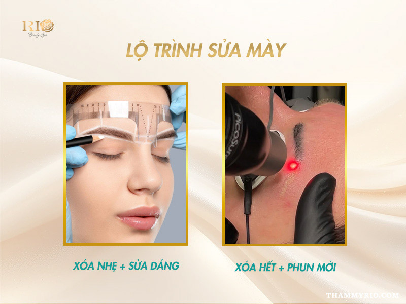 lộ trình sửa lông mày hỏng xóa toàn phần hay hiệu chỉnh nhẹ