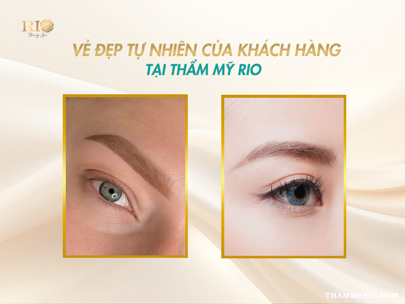 Khám phá lông mày màu nâu socola – Tông màu thời thượng 2026 6 Kết quả thực tế phun lông mày màu nâu socola của khách hàng tại Thẩm Mỹ Rio