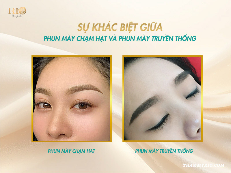 So sánh phun mày chạm hạt sương bay và phun mày truyền thống