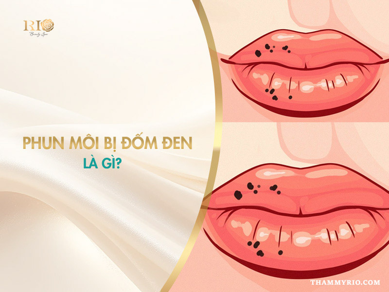 Phun môi bị đốm đen có nguy hiểm không? Dấu hiệu tăng sắc tố sau viêm