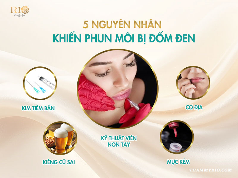 5 Nguyên Nhân Phun Môi Bị Đốm Đen và Cách Xử Lý Ngay 3 5 nguyên nhân hàng đầu khiến tình trạng phun môi bị đốm đen