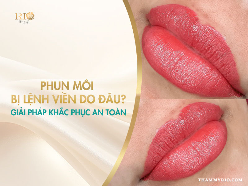 Nguyên nhân phun môi bị lệch viền do đâu? Giải pháp khắc phục hiệu quả