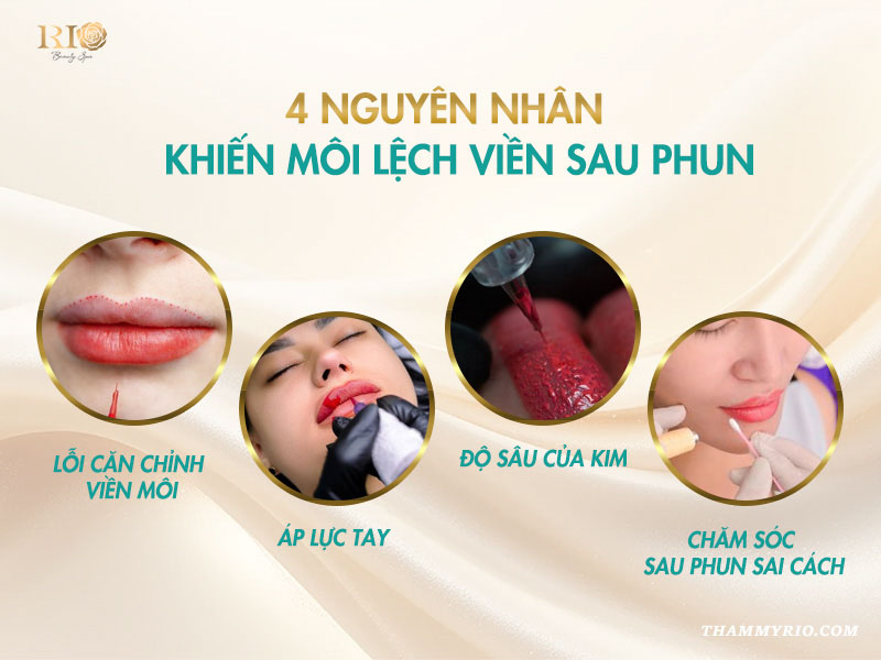 4 nguyên nhân khiến phun môi lệch viền sau phun