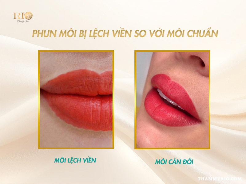 So sánh phun môi bị lệch viền so với môi chuẩn