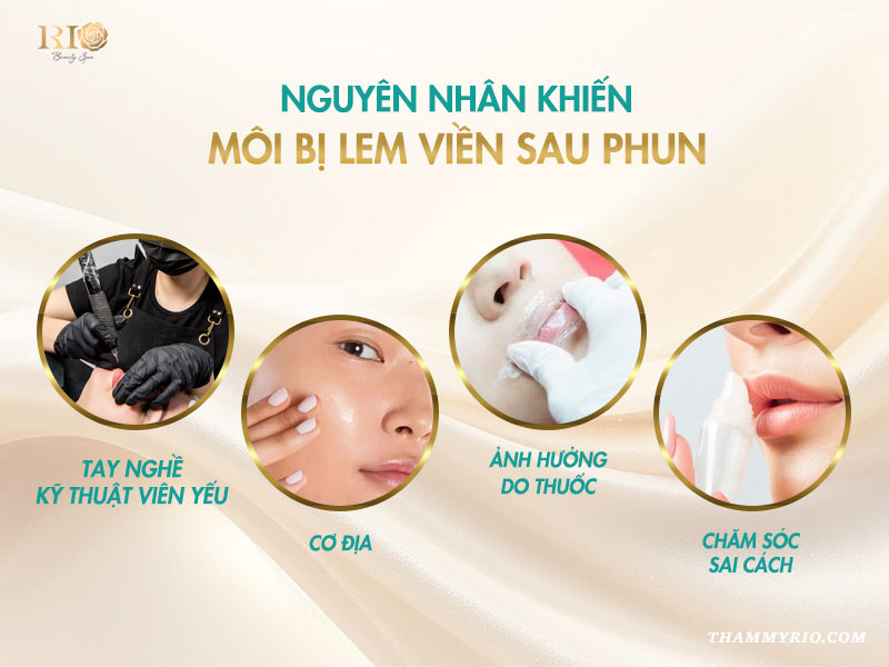Phun môi bị lem viền: 3 Cách xử lý nhanh chóng 2 4 nguyên nhân hàng đầu khiến môi bị lem viền sau khi phun xăm