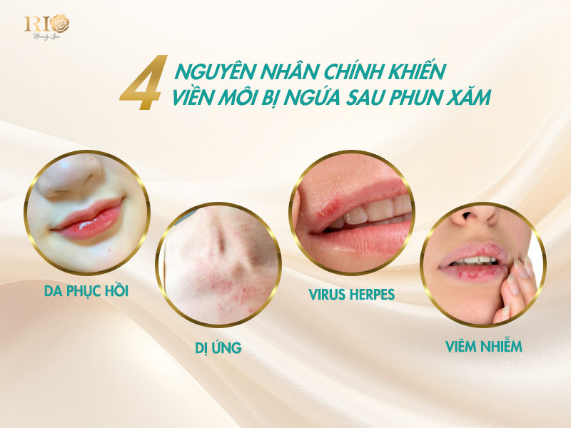 Phun môi bị ngứa viền môi do đâu? Hướng dẫn cách xử lý 3 4 nguyên nhân hàng đầu khiến xăm môi bị ngứa sau khi phun