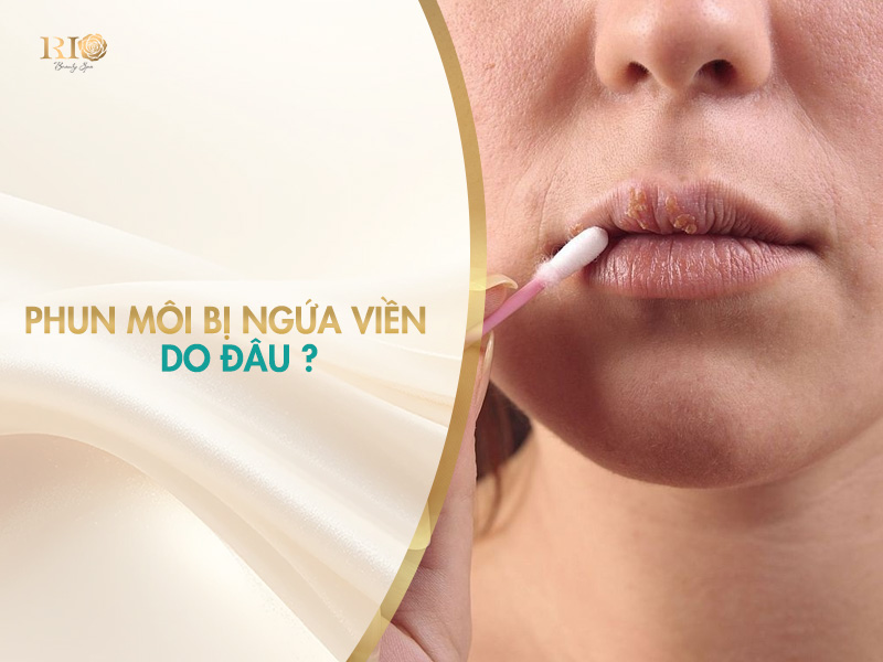 Phun môi bị ngứa viền môi do đâu? Khắc phục tình trạng xăm môi bị ngứa hiệu quả.