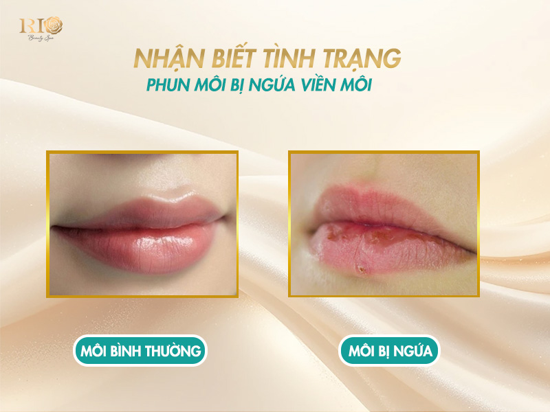 Phun môi bị ngứa viền môi do đâu? Hướng dẫn cách xử lý 2 Nhận biết tình trạng phun môi bị ngứa viền môi sau khi xăm