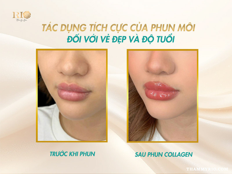 Phun môi có bị già không? 5 Bí quyết chọn màu trẻ trung 3 So sánh hình ảnh trước và sau phun môi collagen, môi từ thâm xỉn chuyển sang hồng hào, căng mọng