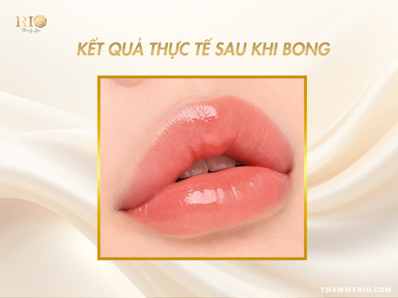 Phun Môi Collagen Màu Cam Đào – Giữ Màu Lâu, Tôn Da Rạng Rỡ 9 Kết quả phun môi collagen màu cam đào cho khách hàng môi mỏng, tạo độ đầy đặn và mềm mịn tự nhiên