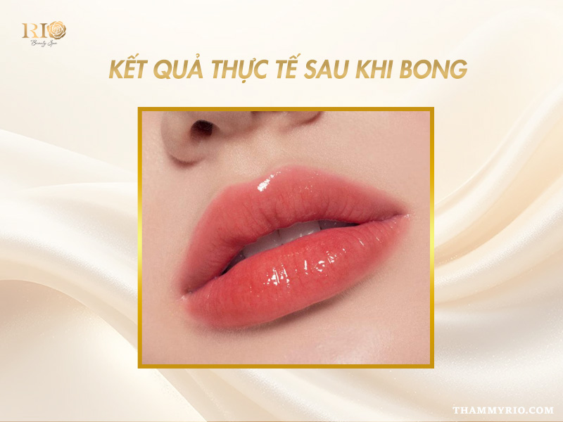 Phun Môi Collagen Màu Cam Đào – Giữ Màu Lâu, Tôn Da Rạng Rỡ 8 Hình ảnh thực tế đôi môi bị thâm xỉn được cải thiện hoàn toàn bằng phun môi collagen màu cam đào